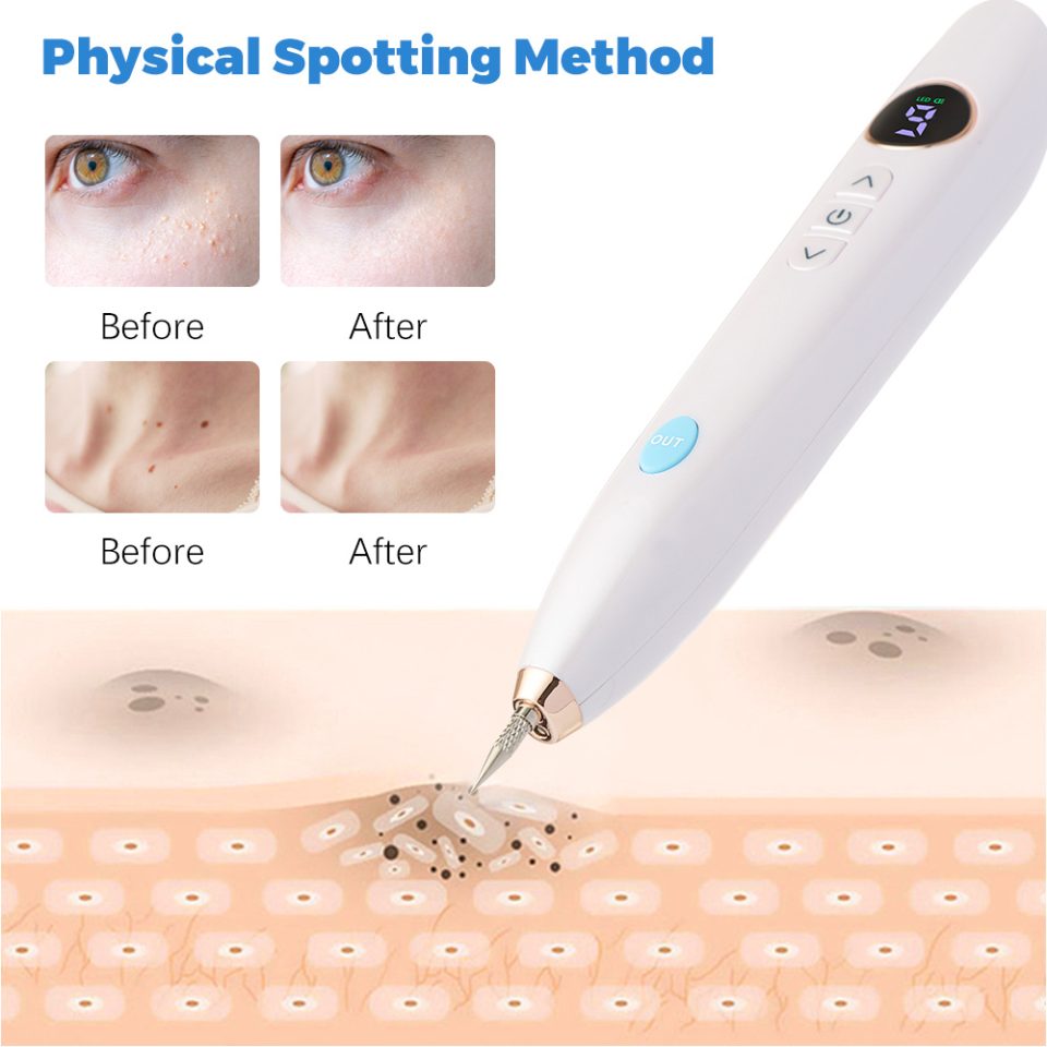 At-Home Plasma Pen Skin Tag Remover