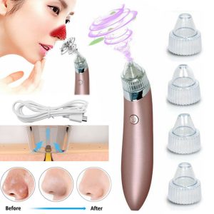 Rechargeable Blackhead Remover
