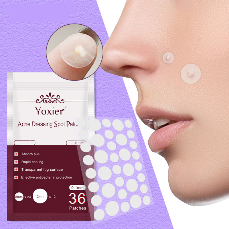 Acne Spot Remover Kit - Pimple Remover Patches + Spot Treatment Cream