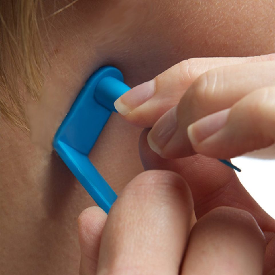 Skin Tag Removal Device