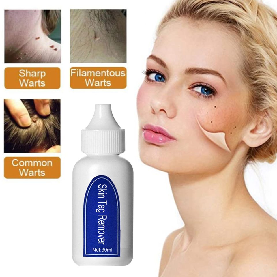 Instant Skin Tag Remover - Fast-Acting Anti-Wart Liquid