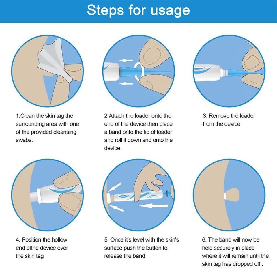 Auto Skin Tag Remover - Painless Mole & Wart Removal Tool