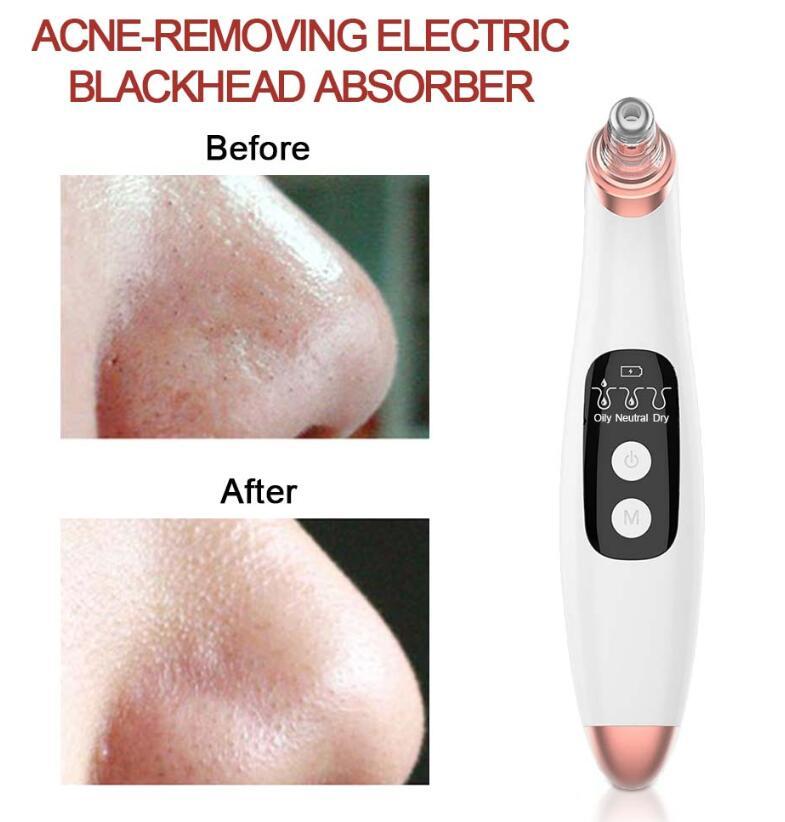 USB Electric Pimple & Blackhead Remover
