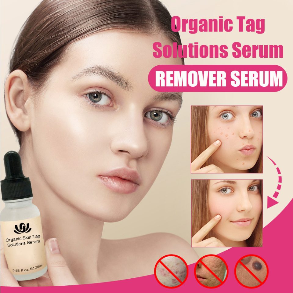 Organic Skin Tag Remover Serum - Mole Removal Cream