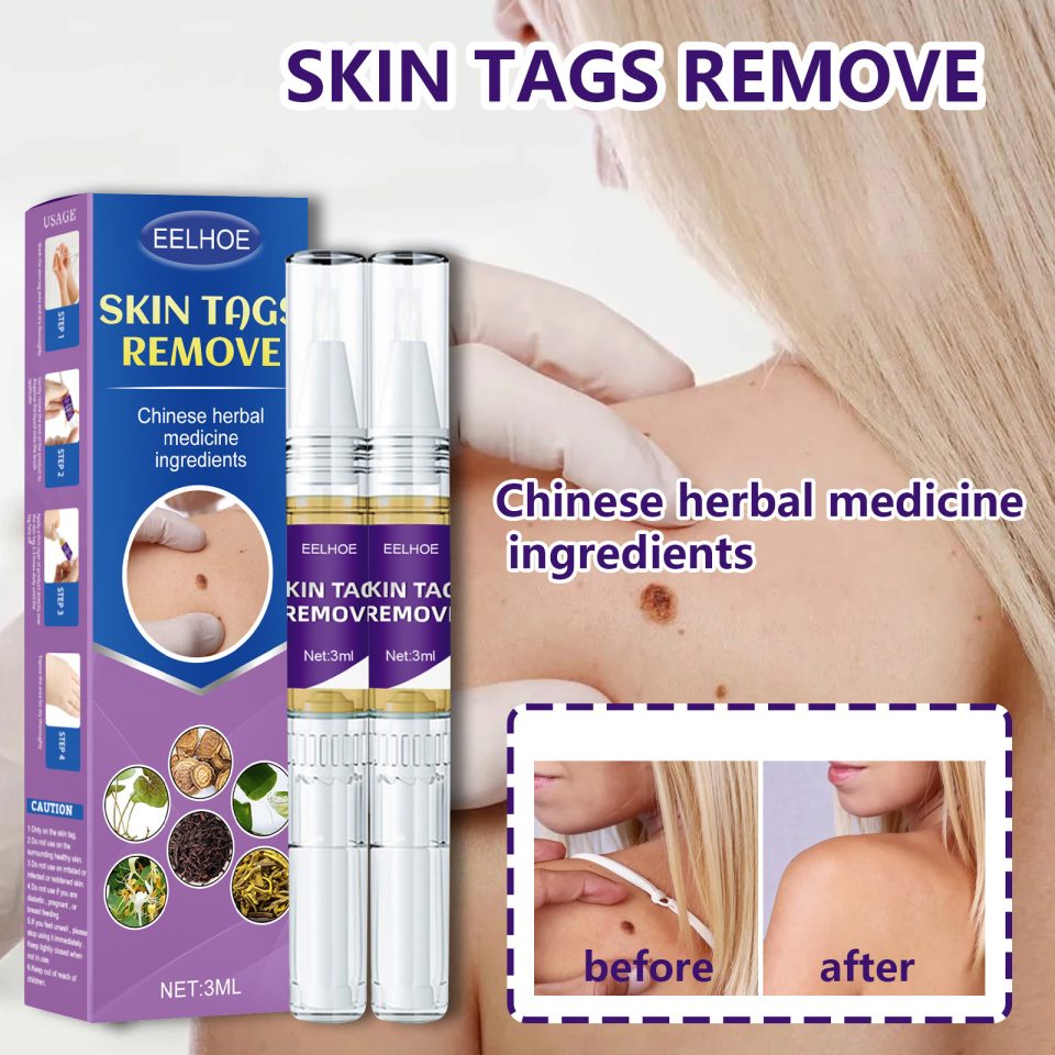 Mole Removal Pen